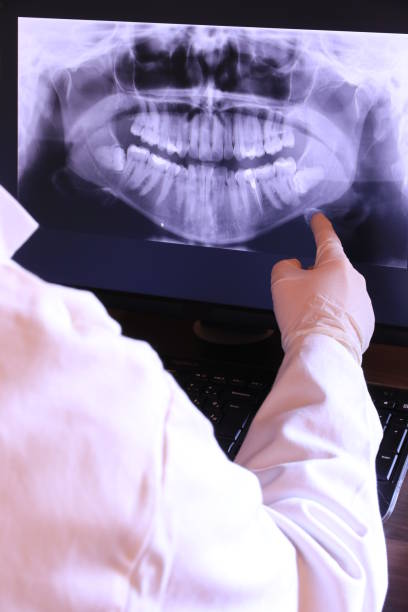 Best Emergency Denture Repair in Clintondale, NY