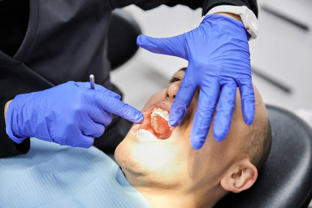 Best Emergency Dental Care for Sports Injuries in Clintondale, NY