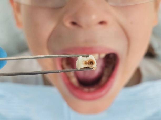 Best Emergency Treatment for Jaw Pain or Injury in Clintondale, NY